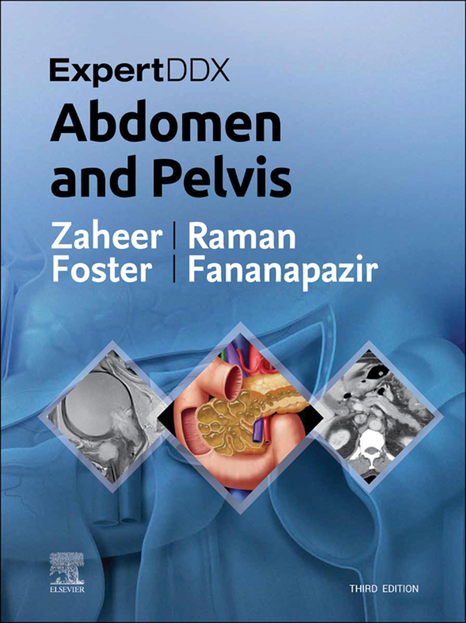 ExpertDDx: Abdomen and Pelvis E-Book - 3rd Edition, Kindle Edition with Audio/Video
